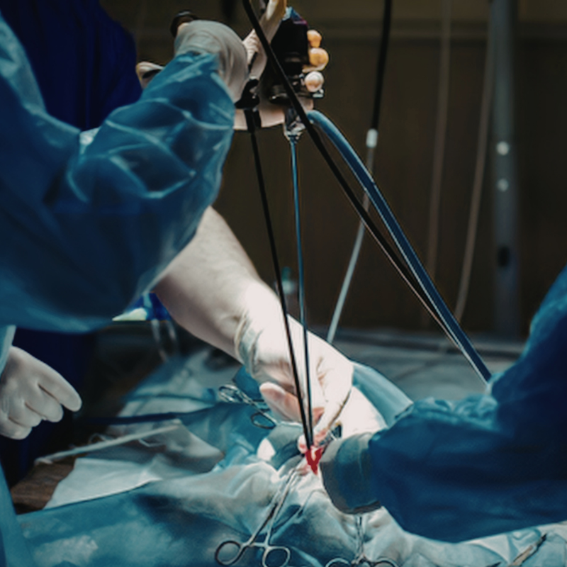 Laparoscopic urology treatment by Dr. Gaurav Das, Consultant Urologist in Chembur, Mumbai